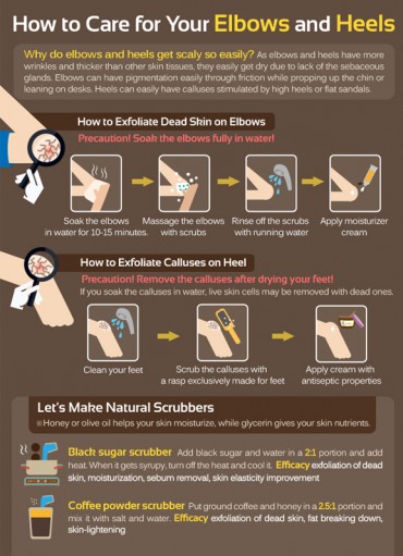 [Kobiz Infographics] How to Care for Your Elbows and Heels