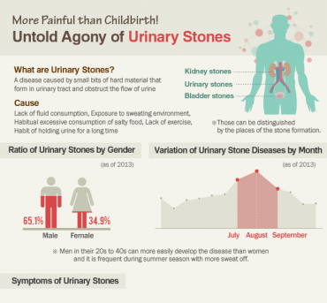 [Infographic] More Painful than childbirth! Untold Agony of Uninary Stones
