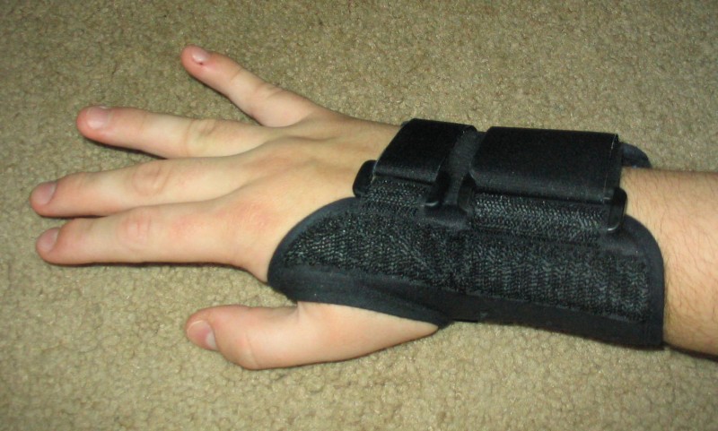 Feel Wrist Pain? Suspect Carpal tunnel syndrome (CTS)