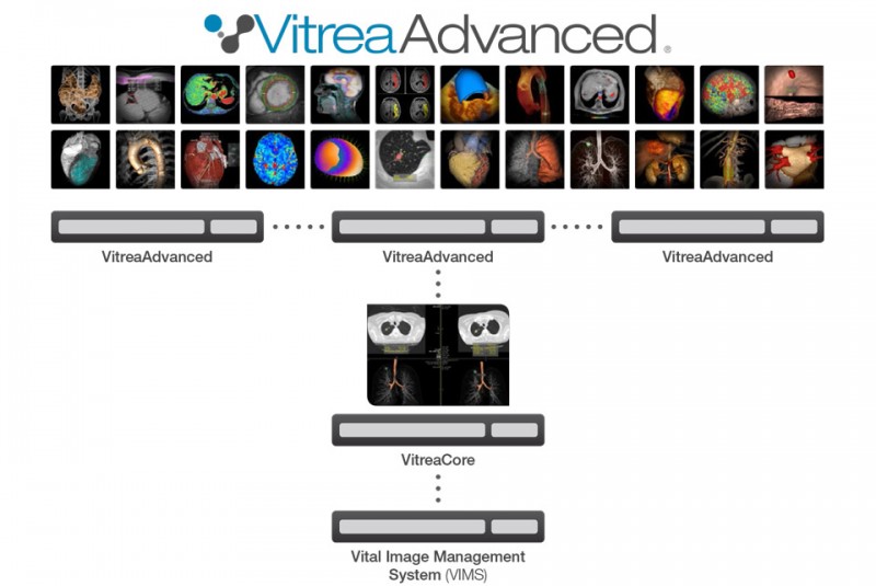 Vital Introduces Vitrea(R) Software, Version 6.7