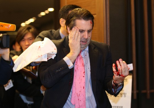 Two Koreas Exchange Accusations over Knife Attack on U.S. Envoy