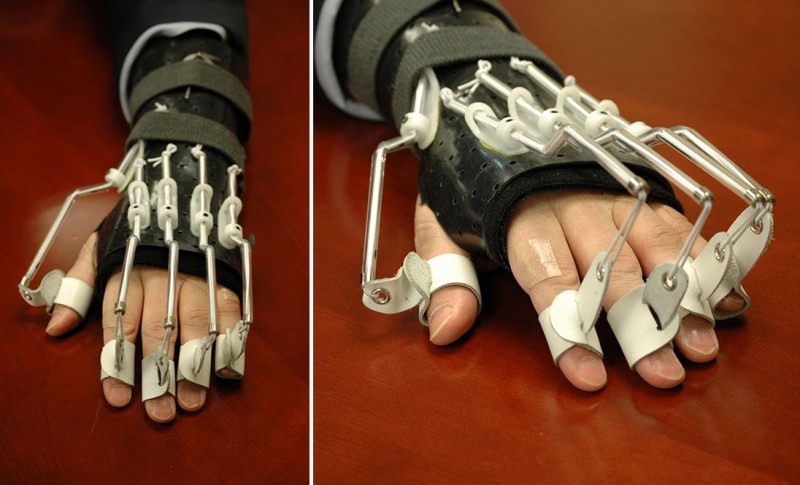 Ambassador Lippert’s Hand Splint Draws Attention with “Robotic-looking” Appearance