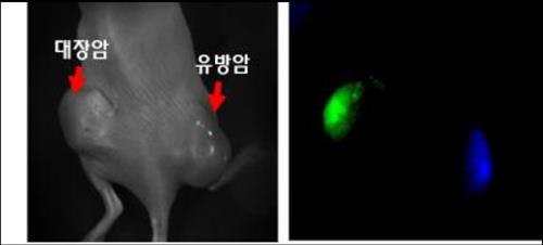 Two different types of dye are placed in the nano-capsules. When the capsules are injected into the human body, and long wavelength light is applied, different colors of cancer cells appear depending on the type of cancer. (Image : Yonhap)