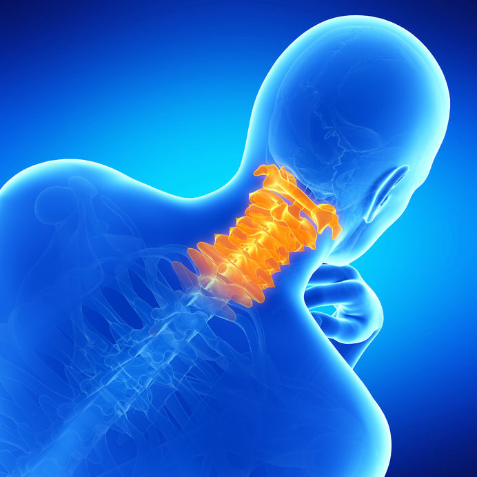 The number of patients suffering from a herniated cervical disc has increased by 24 percent over the past five years. (image: KobizMedia/ Korea Bizwire)