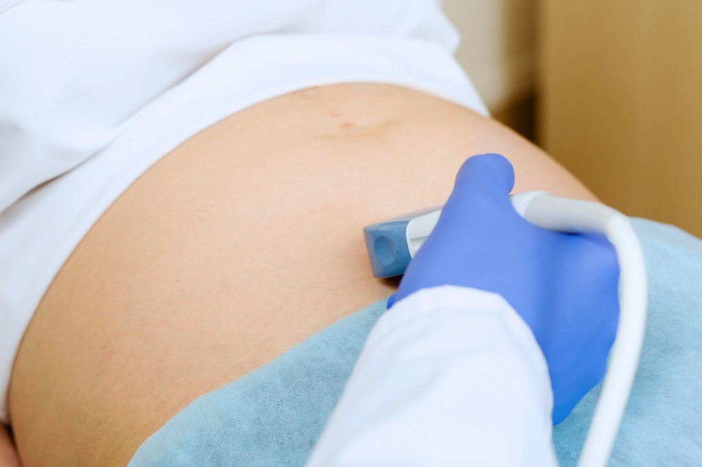 Medical experts are concerned that excessive wariness or suspicion could lead to stress in pregnant women, potentially affecting fetal health. (image: KobizMedia/ Korea Bizwire)
