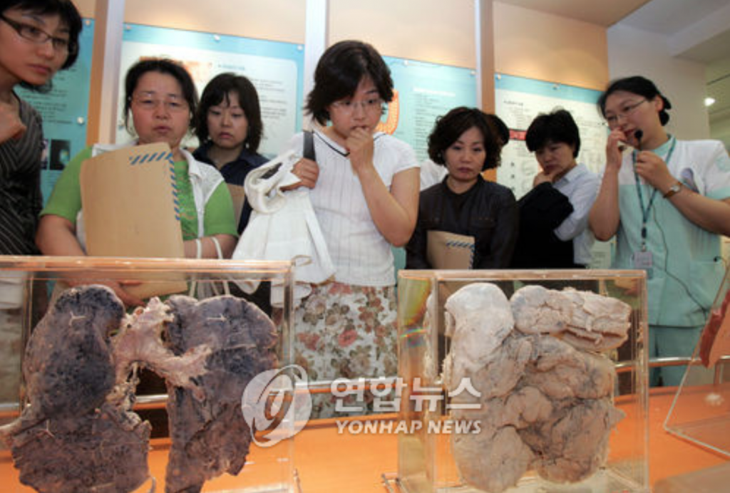 Cancer stricken lungs on display at a Seoul hospital. (image: Yonhap)