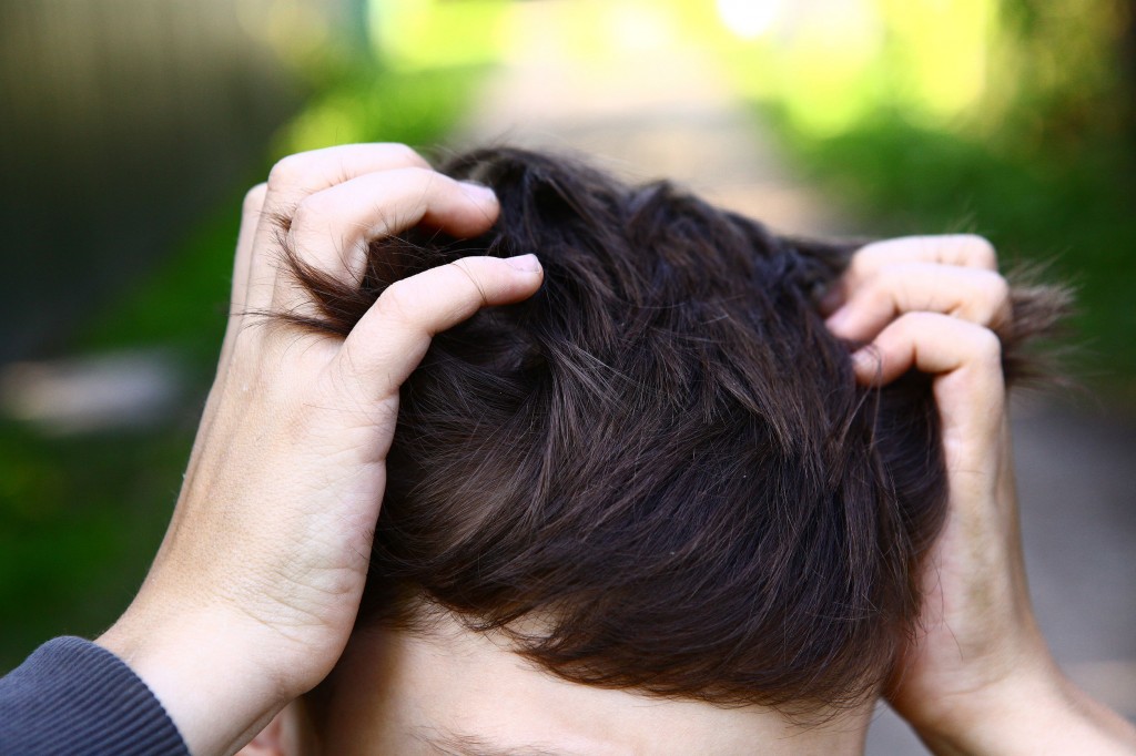 53428636 - preteen handsome boy scratch his head itch because of lice invasion