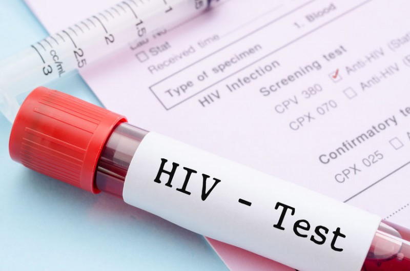 Younger HIV Patients More Likely to Skip Treatment: Study