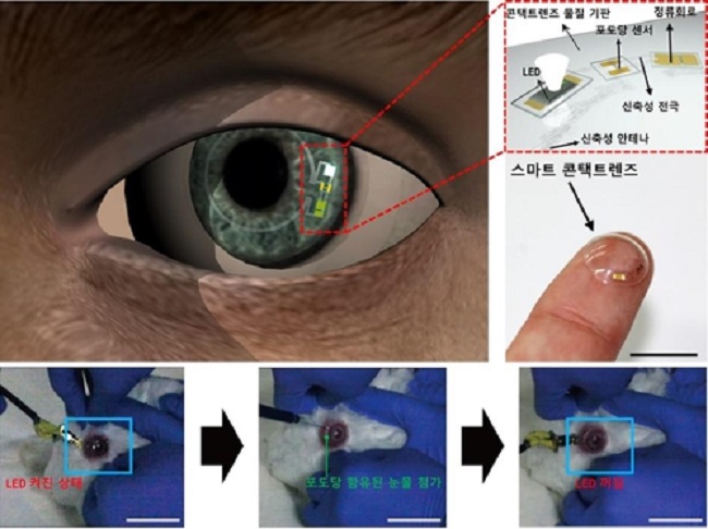 Both the micro LED display and a "high-sensitivity blood glucose sensor" attached to the inner surface of the contact lens are powered by wirelessly transmitted electricity. (Image: UNIST)