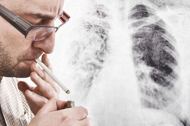 Smoking Less Reduces Lung Cancer Risk by 45 Percent