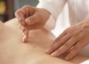 Acupuncture Helps Overcome Depression: Study