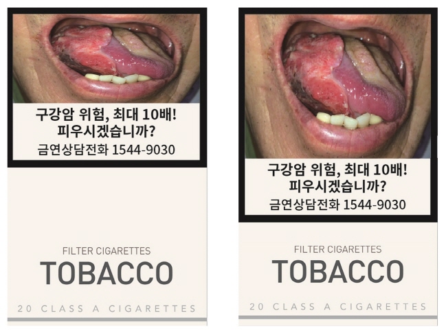 This file photo released by the health ministry in July 2019 shows the heightened risk of smokers contracting oral cancer.