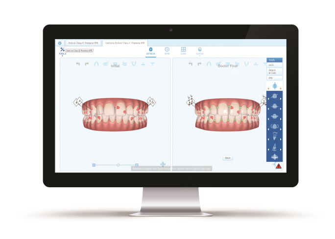 Align Technology Launches New Invisalign System Innovations for Orthodontic and Restorative Dental Treatment Planning with Integration of CBCT into ClinCheck Treatment Planning Software