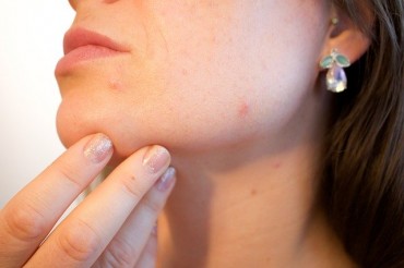 Thin and Transparent Thermal Patch Developed to Cure Acne