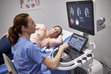 Philips Expands its Dedicated Cardiovascular Ultrasound Offering by Launching Affiniti CVx for Increased Productivity