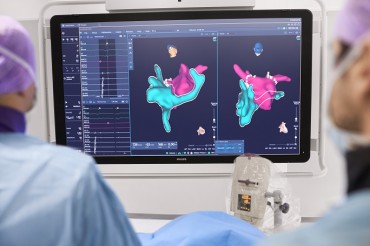 Philips Announces New Imaging and Workflow Enhancements for KODEX-EPD Cardiac Imaging and Mapping System to Treat Heart Rhythm Disorders