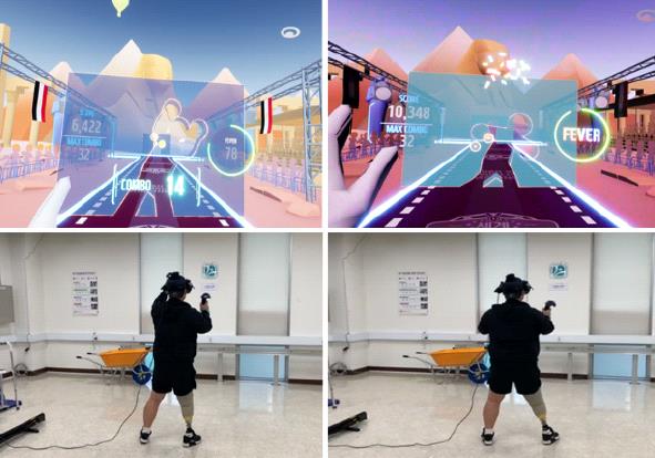 VR Games Can Help Transtibial Amputees with Rehabilitation: Study