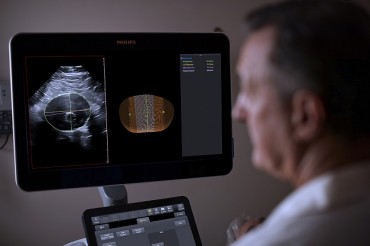 Philips Integrates 3D Ultrasound with Innovative Software for Breakthrough in Surveillance of Abdominal Aortic Aneurysms