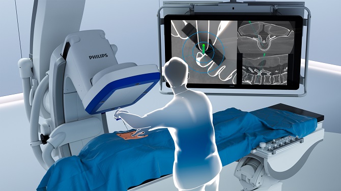 Philips Introduces ClarifEye Augmented Reality Surgical Navigation to Advance Minimally-invasive Spine Procedures