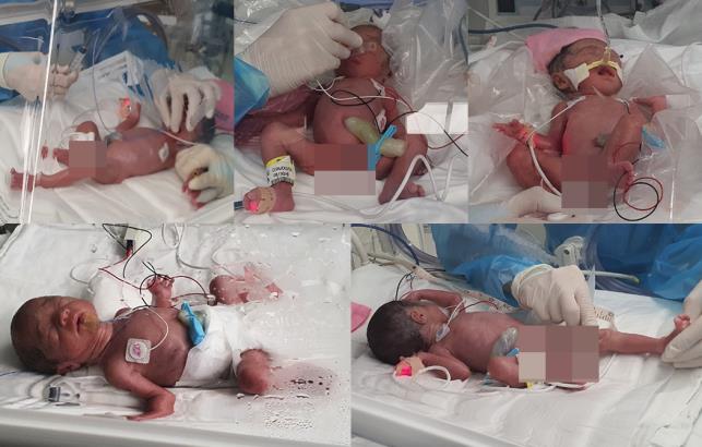Quintuplets Born for First Time in 34 Years in S. Korea