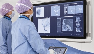 Philips at ESOC 2022: Showcasing Integrated Solutions Across the Stroke Care Pathway
