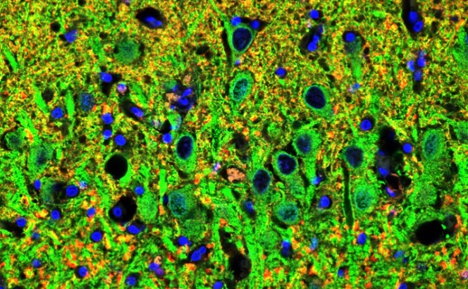 Hippocampus (memory centre) of an older dog with dementia-like syndrome successfully treated with S2N's cells. It is packed with green cells that are new neurons (brain cells) and yellow dots, new synapses (connections between brain cells).