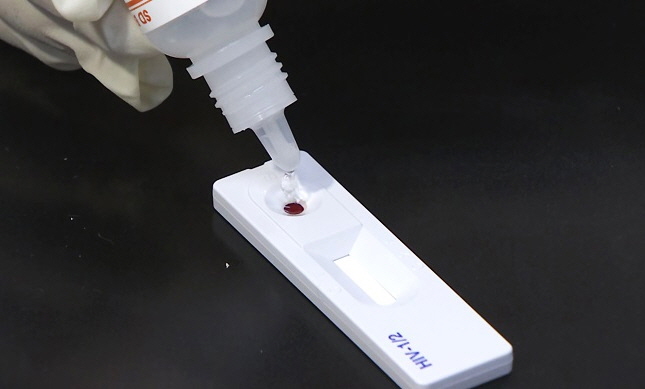 An HIV test kit (Yonhap)
