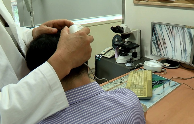 Controversy Sparks over Subsidies for Hair Loss Treatment