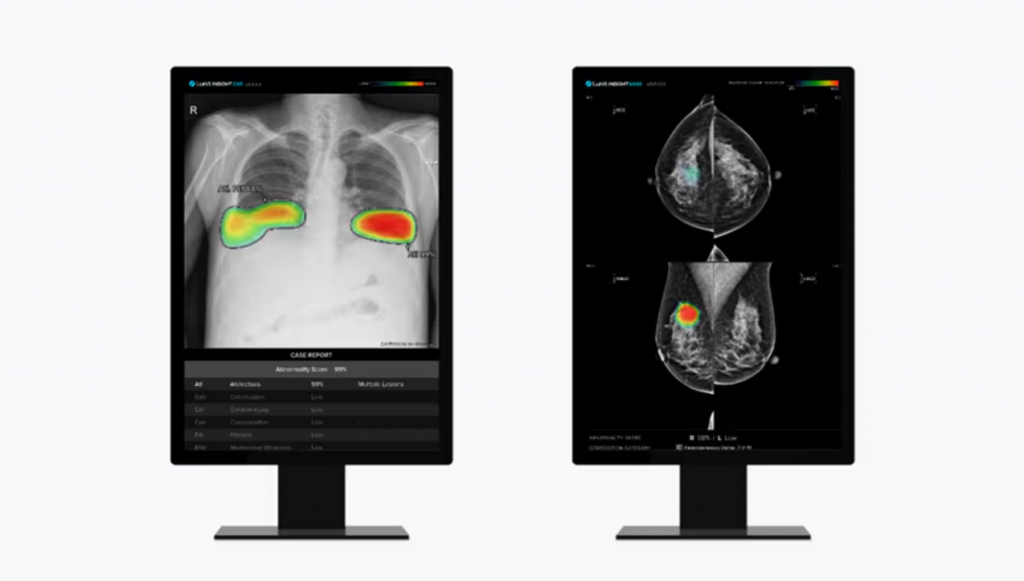 Lunit Insight CXR (left), an AI image analysis solution for chest x-rays, and Lunit Insight MMG, an AI image analysis solution for mammograms. (Image courtesy of Lunit)