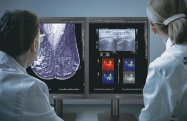 LG Electronics Unveils High-Resolution Monitor for Breast Cancer Screening