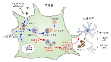 Brain’s Star-Shaped Cells Show Promise in Alzheimer’s Treatment, Korean Study Finds