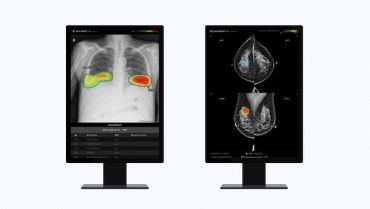 South Korean AI Healthcare Companies Make Strides in Global Market