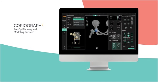 Smith+Nephew introduces CORIOGRAPH™ Pre-Op Planning and Modeling Services for Total Hip Arthroplasty