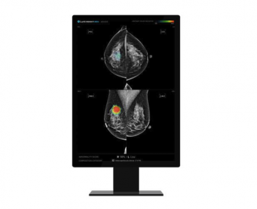 AI Tool Helps Doctors Detect Previously Missed Breast Cancer, Says Korean Physician