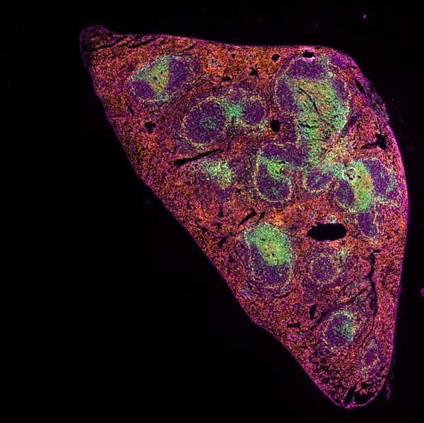 5 μm FFPE section of mouse spleen simultaneously stained with 7 IF markers plus DAPI (not shown). Imaged on ZEISS Axioscan 7 spatial biology
