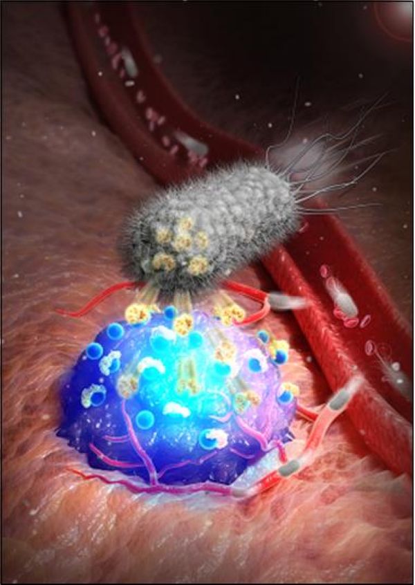 Bacteria-Based Fluorescence May Revolutionize Precision Cancer Surgery