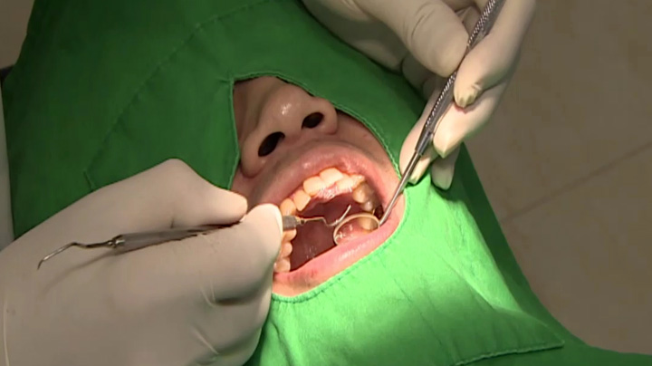 Oral Health Tied to Increased Cancer Risk and Mortality in Older Adults, Korean Study Finds