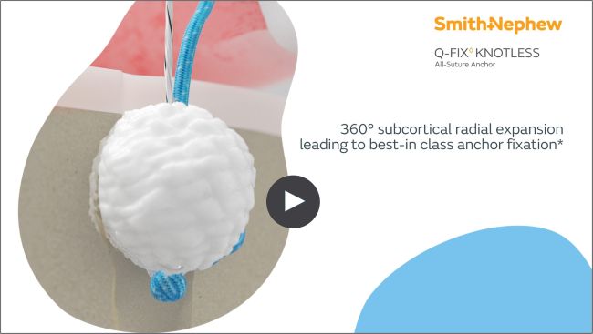 Smith+Nephew expands market-leading fixation strength of Q-FIX™ All-Suture Anchor portfolio with new knotless option