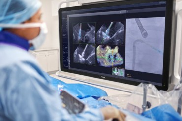 Philips brings AI into the procedure room to assist doctors during heart valve repair