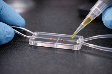 KAIST Develops Organ-on-a-Chip to Trace How Drug Damage Spreads From Muscle to Kidney